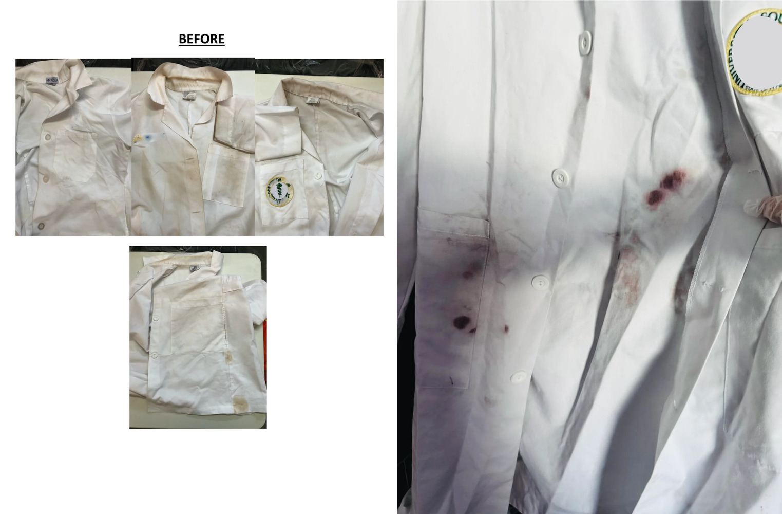 Before - Stained lab coats with ink and blood